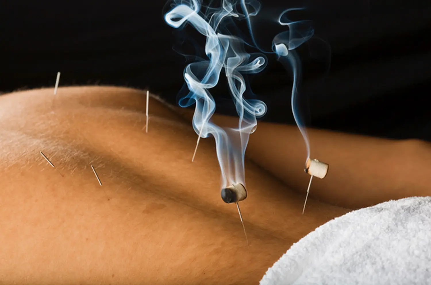 Annette Jonas, Moxibustion